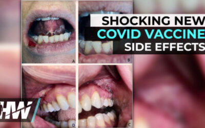 SHOCKING NEW Cover Vaccine Side Effects
